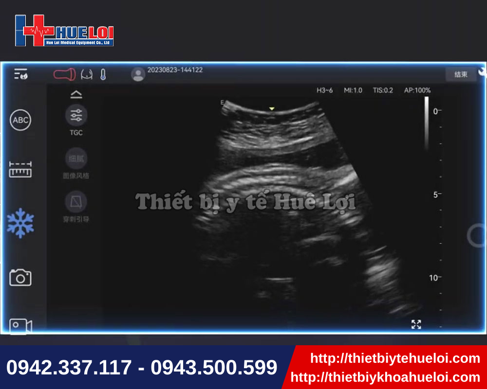 Máy siêu âm cầm tay cho hình ảnh sắc nét