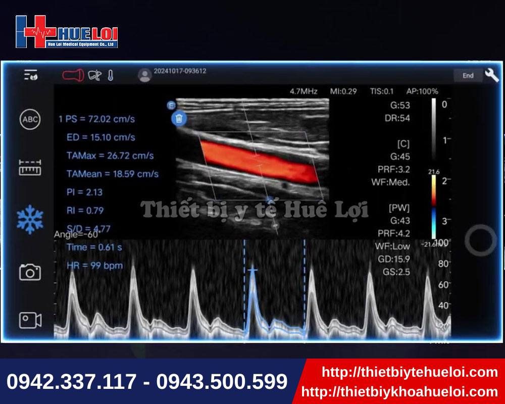 Thiết bị siêu âm di động đa dạng chế độ hiển thị