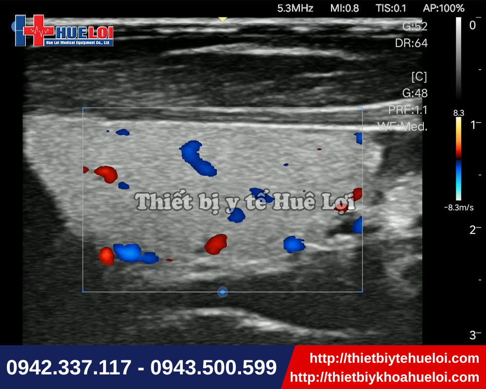 Thiết bị siêu âm di động tiện lợi