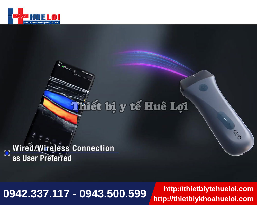Đa dạng kết nối với máy siêu âm di động