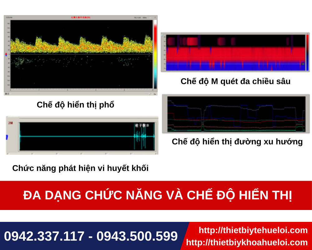 Thiết bị đánh giá mạch não đa chức năng
