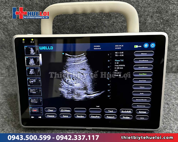 máy siêu âm mini giá rẻ chất lượng