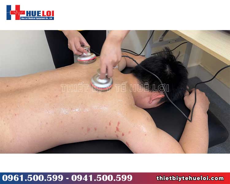 chế độ xung trị liệu máy điện châm không kim
