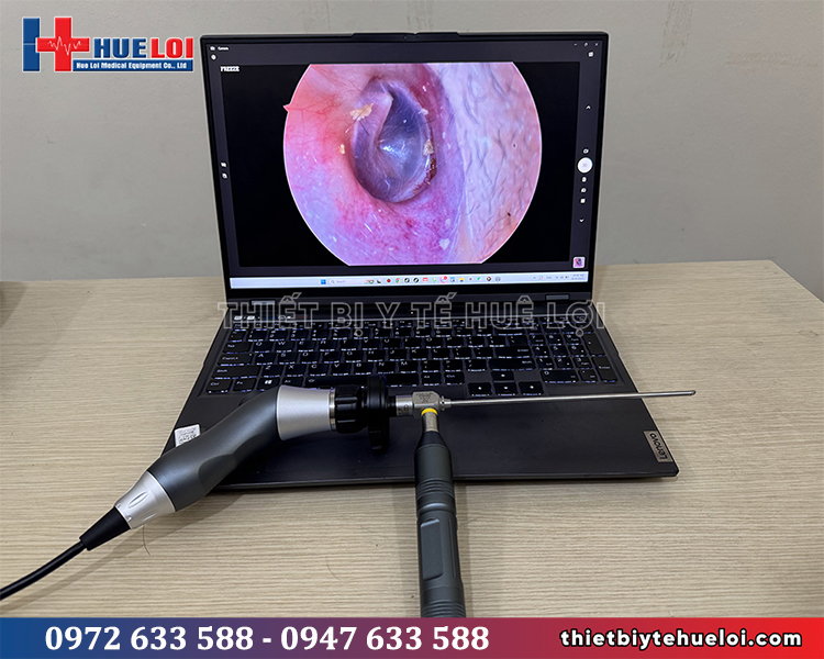 máy nội soi tai mũi họng cho phòng khám