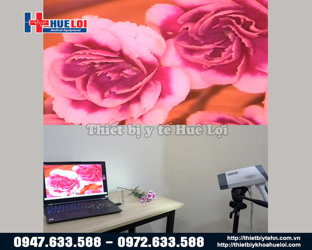 bộ lọc thiên đỏ máy soi cổ tử cung