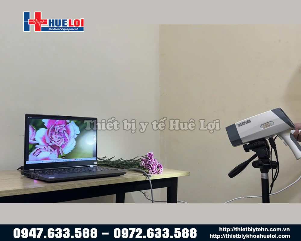 máy soi cổ tử cung full hd