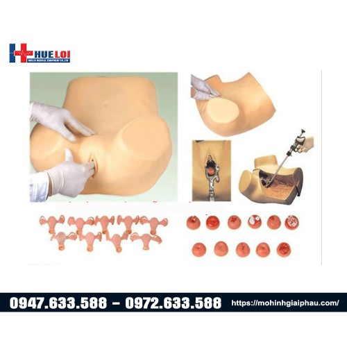 mô hình khám chẩn đoán các bệnh lý phụ khoa