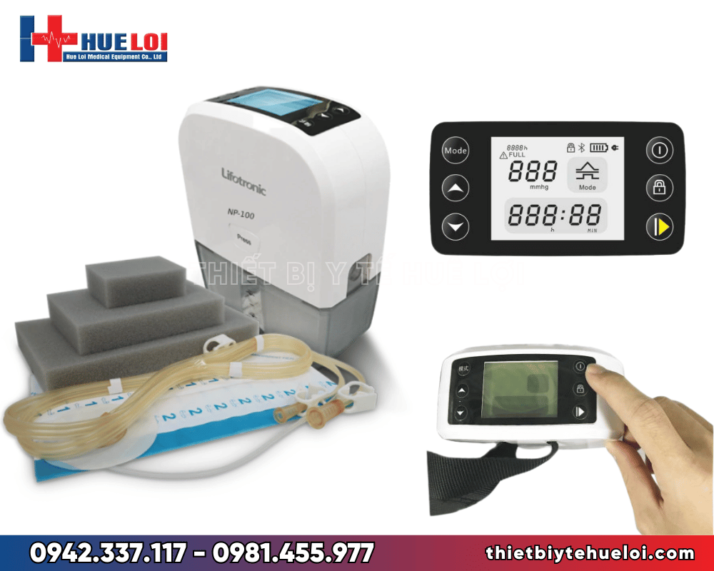 Điều trị loét bằng phương pháp hút liên tục áp lực âm 