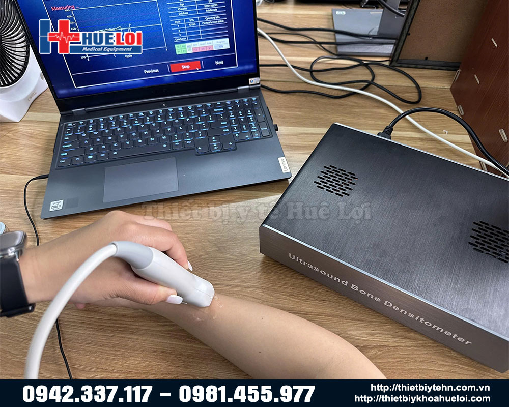 máy đo độ loãng xương chất lượng