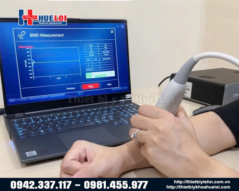 máy đo loãng xương giá rẻ